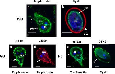 Giardial lipid rafts share virulence factors with secreted vesicles and participate in parasitic infection in mice